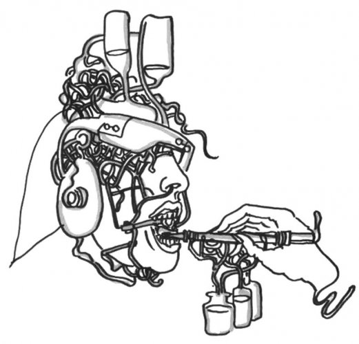生活随笔：有脑子是件好事